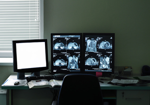 Picture of a radiology room that has computer monitors up of MRI images.